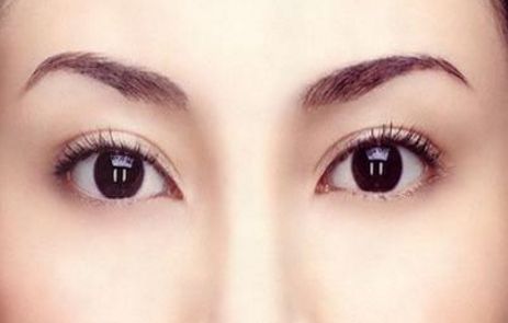 中國哪家假體隆胸醫(yī)院好？2023排名TOP10及專家推薦