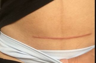 如何選擇新疆做胎記醫(yī)院，哪家好？