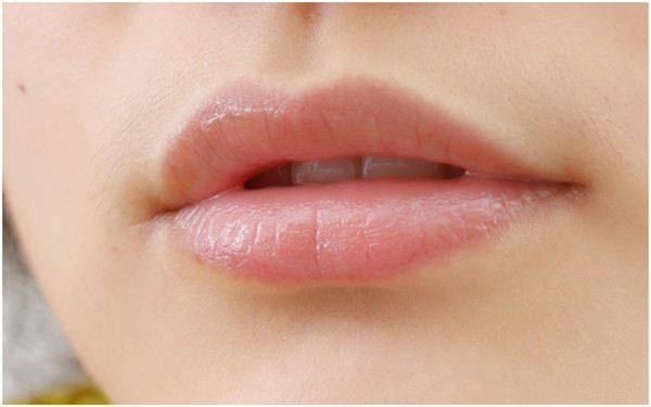 2023鹽城眉間紋打玻尿酸前十強醫(yī)生排名榜(葛乃航、杜康、于海洲人氣口碑實力三合一推薦)