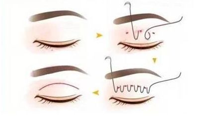 南寧夢想醫(yī)療美容門診部的項(xiàng)目有哪些值得了解的特色？