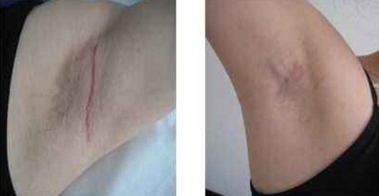 深圳激光美容醫(yī)院排名及口碑哪家好？