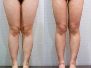 南京眼皮松弛醫(yī)院排名及口碑調(diào)查：哪家醫(yī)院是患者首選？