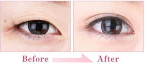 石家莊碧蓮盛-開啟新植發(fā)時(shí)代，選擇明星級植發(fā)醫(yī)生