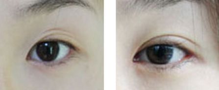 汕頭市整形醫(yī)院有哪些？哪家整形醫(yī)院在汕頭市口碑好？