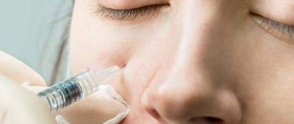 西安哪家醫(yī)院激光去斑效果最好？