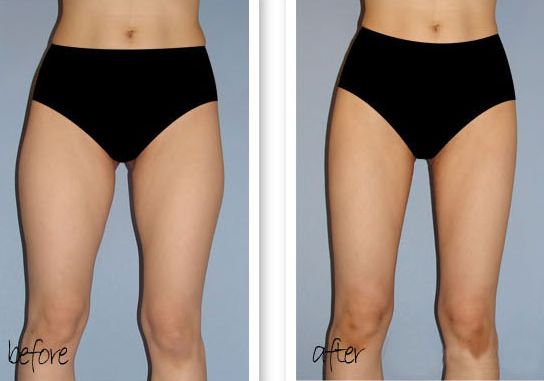 合肥隆鼻好整形醫(yī)院是哪家？綜合口碑來(lái)推薦！