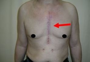 福州果酸換膚哪家醫(yī)院好？