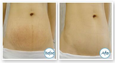 不得不佩服武漢蜜司楊蓉的雙眼皮，簡直完美！讓我們來了解一下醫(yī)院簡介、看看一些案例以及價格的超全信息。