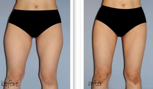 南京哪家醫(yī)院除雀斑好？醫(yī)院雀斑治療排名及效果對(duì)比！