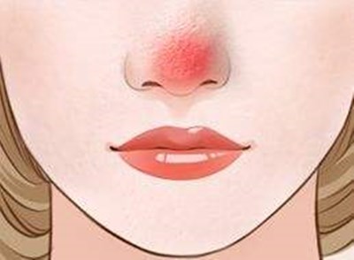 上海九院哪位醫(yī)生做雙眼皮技術(shù)好？價格如何？附帶成功案例分析