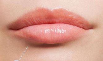 2023衢州額頭填充脂肪前10位專家排行榜(白慧媛、張惠華、梁世家收費(fèi)不貴評價(jià)也好)