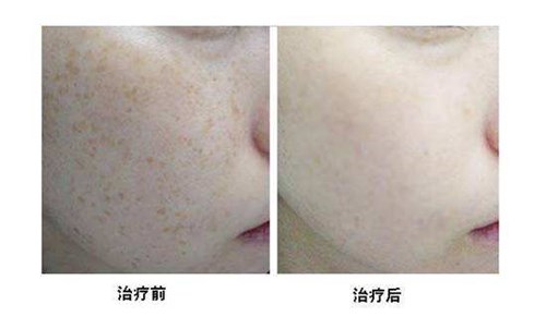 2023西昌專業(yè)腿部吸脂減肥手術(shù)正規(guī)專家口碑前十位(湯穎峰、吳強(qiáng)、劉光毓好評(píng)合集推薦)