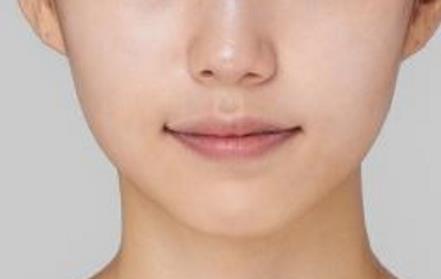 2023承德微雕祛除額頭紋上榜清單前十名醫(yī)生(于學(xué)勇、王銘、孫喜平行業(yè)強(qiáng)中強(qiáng)！)