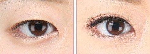 陜西省郴州市有哪些醫(yī)院值得推薦呢？