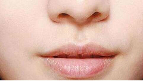 2023廈門眼鼻五官精細整形評分前十名專家(徐威、羅玲、譚云口碑派入圍，想做整形就找他們)