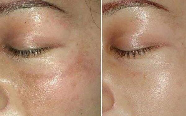 廣州領(lǐng)銜！全新發(fā)布隆鼻專家排行榜！盤點(diǎn)醫(yī)生資料！