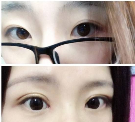 2023武漢玻尿酸去皺在榜單前十位專家(曾高、李蕓、吳俊華關(guān)注多選擇多)