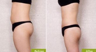 廣州雙眼皮手術(shù)哪家醫(yī)院好？專家推薦的地標醫(yī)療機構(gòu)一覽