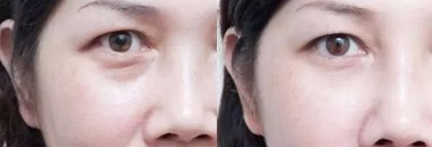 保定市整形外科哪家好？2023年最新榜單及專(zhuān)家推薦！