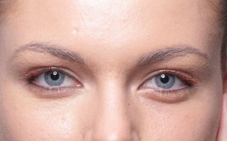 深圳哪家醫(yī)院的埋線(xiàn)減肥效果最好？