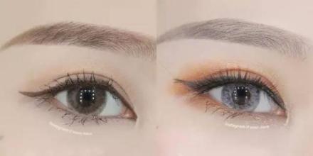 2023杭州面部填充眼紋醫(yī)生前10位上榜名單(馬瑞宣、王正云、司婷婷領(lǐng)銜榜首~)