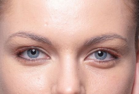 成都有哪些專業(yè)的祛斑祛痘印機(jī)構(gòu)值得推薦？