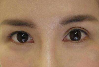 2023杭州自體脂肪豐眉弓正規(guī)專家口碑TOP10強(張常、程磊、黃臺曼口碑擅長、價格簡介盤點)