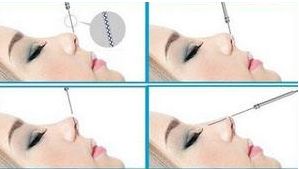 四川哪家醫(yī)院治療狐臭效果好，口碑最佳？