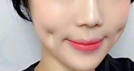 上海超聲刀哪家醫(yī)院做得好？專家推薦，超聲刀手術(shù)最佳選擇