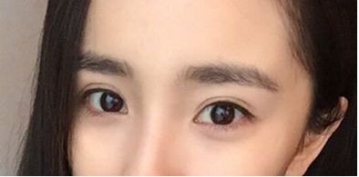 珠海市祛斑好的醫(yī)院哪家靠譜？