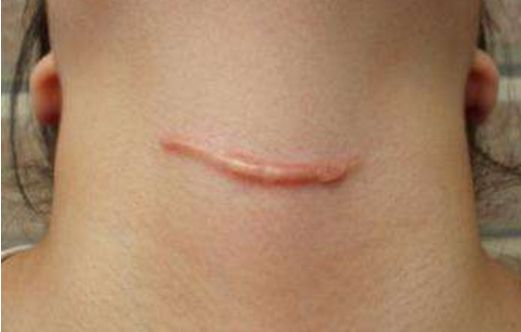 衡陽去痘坑哪家醫(yī)院好？-衡陽市專業(yè)祛痘修復(fù)醫(yī)院排行榜