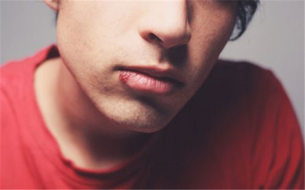 2023東營(yíng)水光針祛除口周紋專家前10位口碑排行(王淑琴、郭惠冉、王淑琴明星認(rèn)可)