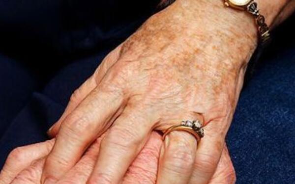 廣州曙光醫(yī)學美容醫(yī)院Charles假體豐胸術(shù)成果如何？