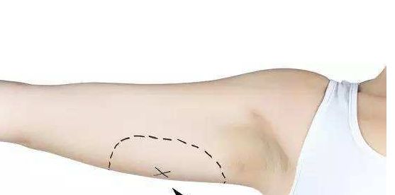 南京去除黃褐斑醫(yī)院排名及口碑，哪家值得信賴？