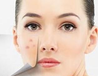 廈門哪家醫(yī)院墊鼻子好？專家推薦的Top5廈門墊鼻子好醫(yī)院