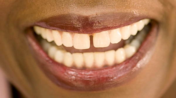 2023揭陽隆下巴整形口碑TOP10強(qiáng)醫(yī)生(陳祥、趙學(xué)燕、李鐵軍技術(shù)好、還靠譜！)