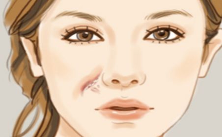 天津有哪些醫(yī)院的祛痘效果好？哪家醫(yī)院的祛痘效果最佳？