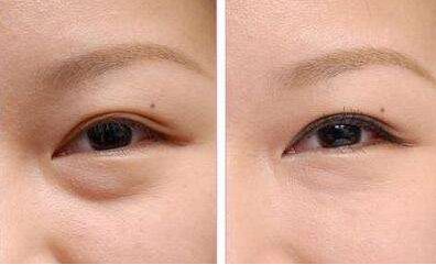 洛陽有減肥醫(yī)院哪家好？瘦身專家推薦幫您選擇洛陽最好的減肥醫(yī)院