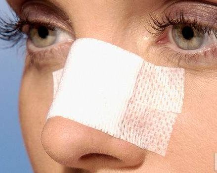 徐州雙眼皮哪家醫(yī)院好？選擇徐州哪家專業(yè)雙眼皮醫(yī)院效果好