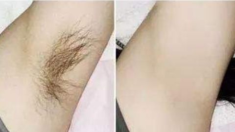 杭州藝星徐利剛醫(yī)生隆鼻項目靠譜嗎？技術(shù)操作曝光，口碑如何？