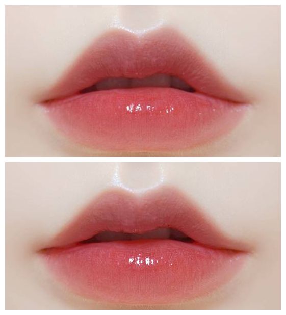 揭秘上海注射玻尿酸醫(yī)院排行榜，哪家好的口碑最高？