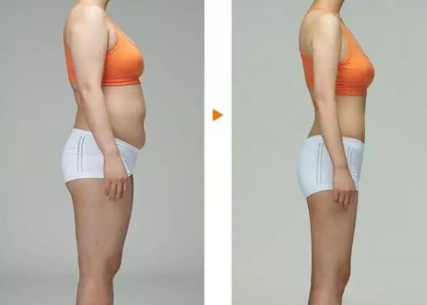 常州去胎記哪家醫(yī)院好？專家推薦常州哪家醫(yī)院胎記治療效果好