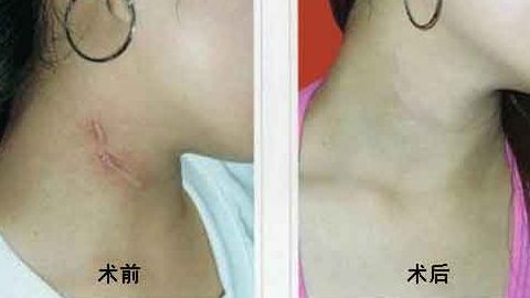 上海中西醫(yī)結(jié)合醫(yī)院整形美容科靠譜嗎？聽說口碑不錯(cuò)！