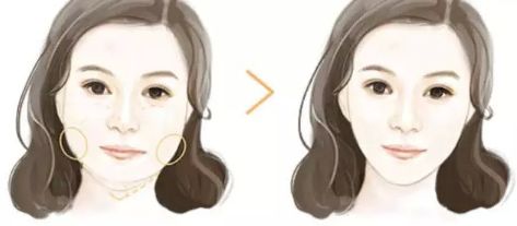 上海哪家下頜骨醫(yī)院好？解析上海下頜骨疾病常見病例及專業(yè)治療！