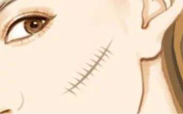 廣州康華清醫(yī)療美容門診部醫(yī)生有哪些擅長項目？醫(yī)院技術(shù)一覽如何？