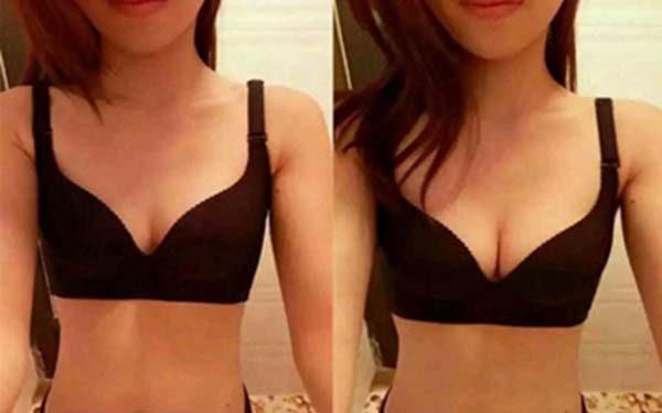 2023柳州玻尿酸自體脂肪豐下巴權(quán)威醫(yī)生口碑前十強(莫利香、榮耀、吳利巧性價比，技術(shù)在線測評)