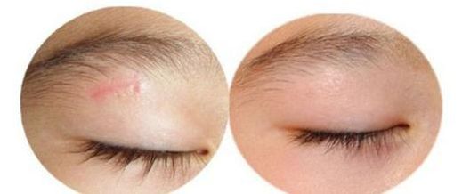 上海顴弓手術(shù)哪家醫(yī)院效果好，專家推薦