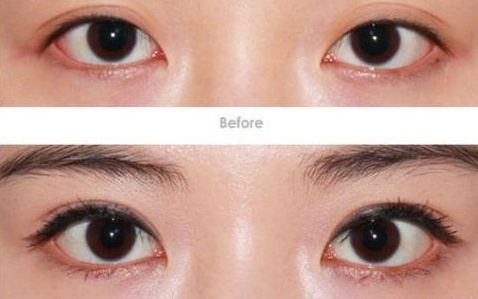 淮安瘦臉針哪家技術好？探究淮安市臉部瘦臉針技術領先的醫(yī)療機構