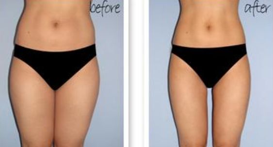 2023北京脂肪頸紋填充醫(yī)生上榜前十強(黃亦凡、尹林、謝海波口碑常青)