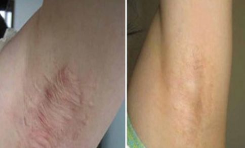 廈門祛雀斑醫(yī)院排名及口碑，哪家好？